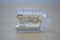 Plastic Injection Products, Denture Articulation Frame, Partial 1